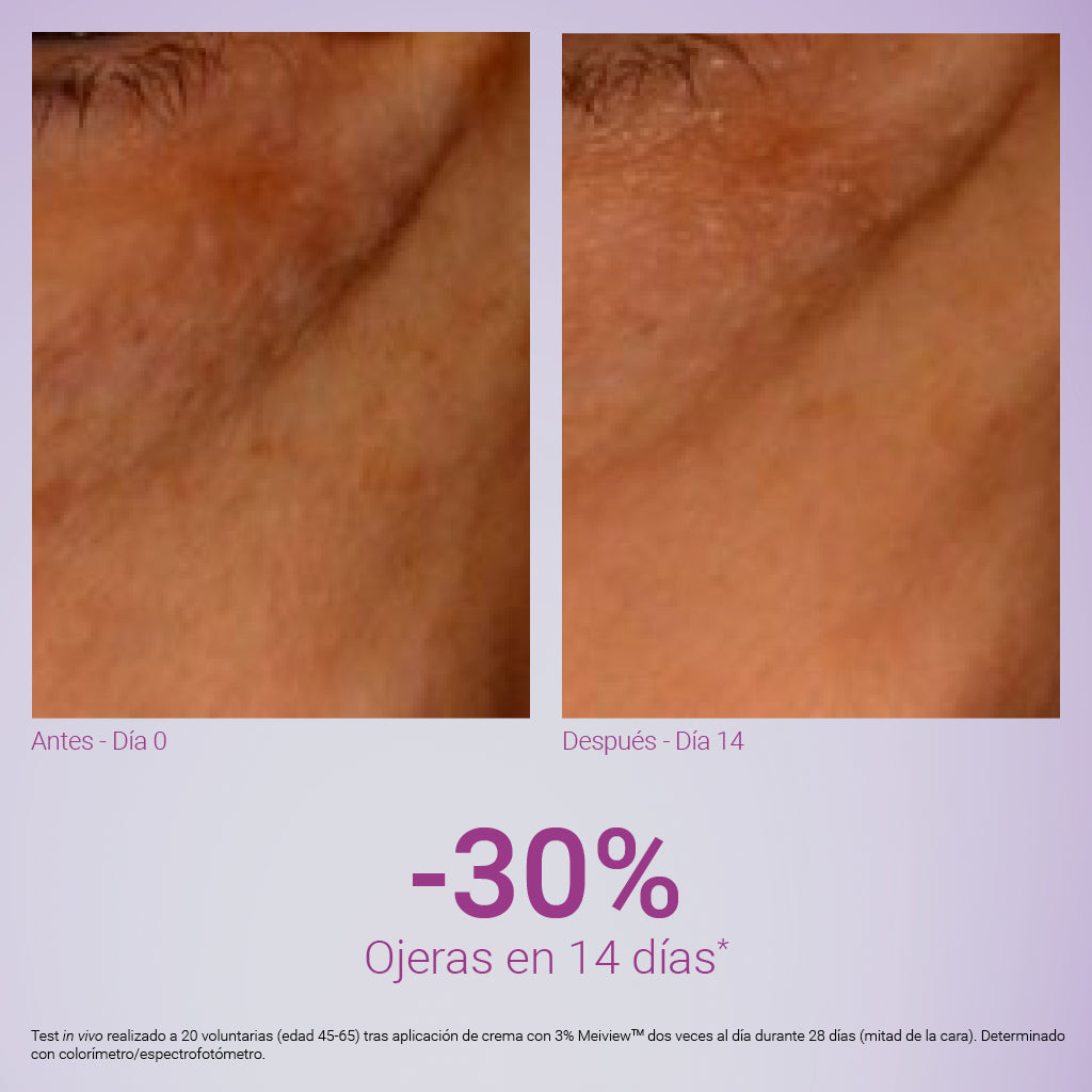 XPERT EXPRESSION CONTOUR  1 TUBO 15 ML